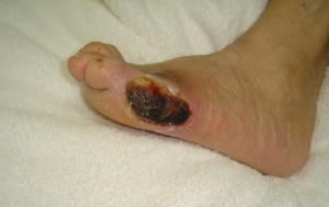 wound2nov25